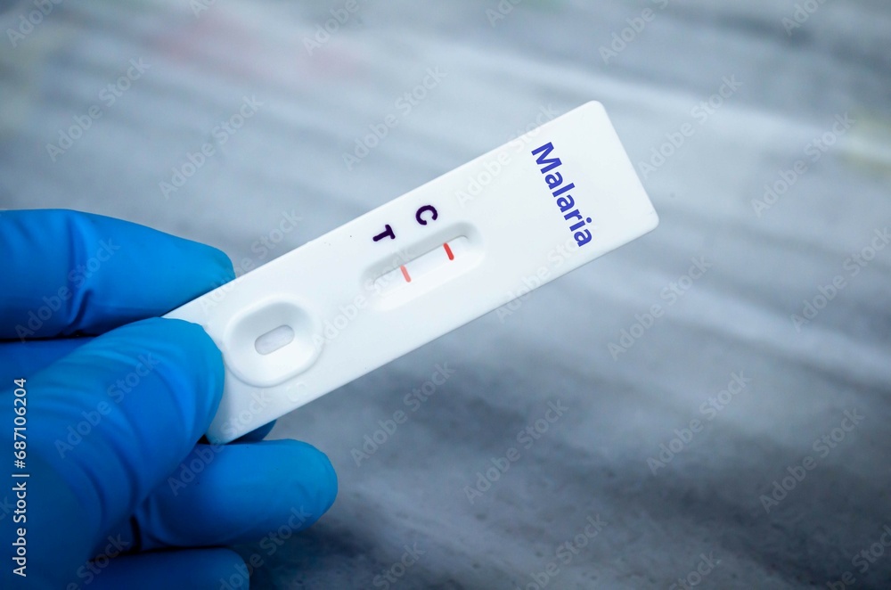 Blood sample of patient positive tested for malaria by rapid diagnostic test. Blood sample of patient positive tested for malaria by rapid diagnostic test.