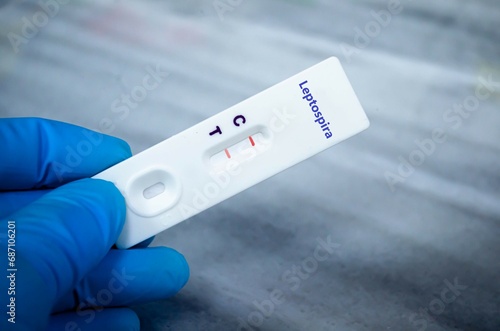 Blood sample of patient positive tested for leptospira by rapid diagnostic test. photo