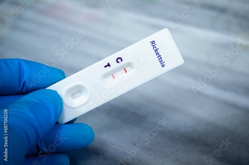 Blood sample of patient positive tested for rickettsia by rapid diagnostic test. photo