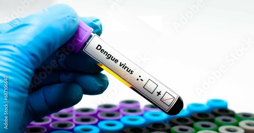 Blood sample of patient positive tested for dengue virus. photo