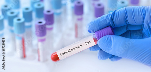 Doctor holding a test blood sample tube with cortisol hormone test on the background of medical test tubes with analyzes. photo