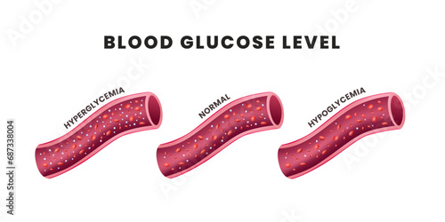 Glucose in blood vessel. glucose level, hyperglycemia hypoglycemia blood and sugar stream at blood