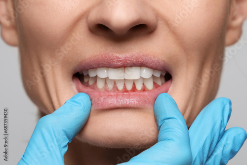 Fotografia Doctor examining woman's inflamed gum on grey background, closeup