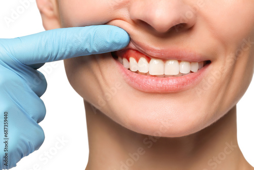 Doctor examining woman's inflamed gum on white background, closeup