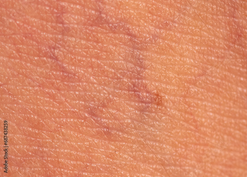 Close-up of veins on the skin. Macro