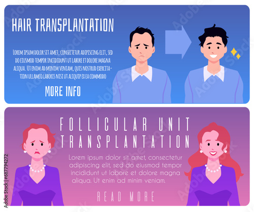 Posters about hair transplantation and fue procedure, vector illustration