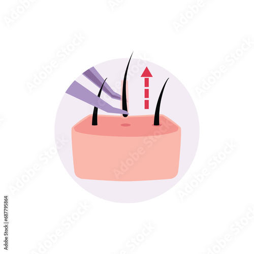 Extraction of follicular units using tweezers, alopecia hair transplantation, restoration procedure vector illustration