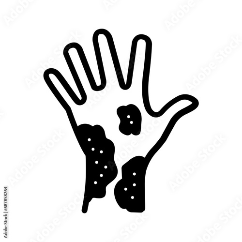 Solid black icon for Eczema