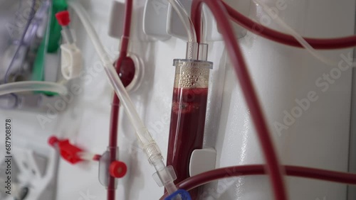 Hemodialysis bloodline tubes connected to hemodialysis machine. Health care, blood purification, kidney failure, transplantation. Part of a dialysis equipment during process of blood filtration. photo