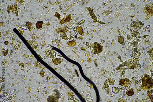 soil sample containing soil biology, with bacteria, fungi, amoeba, flagellate, and arcella, on a sustainable agricultural farm in australia photo