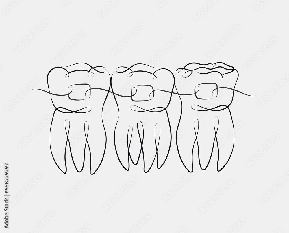 Teeth with braces illustration drawing in linear style on white background