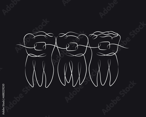 Obraz na płótnie Teeth with braces illustration drawing in linear style on black background w salonie