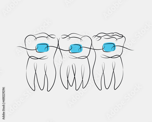 Obraz na płótnie Teeth with braces illustration drawing in linear style on white and blue background w salonie