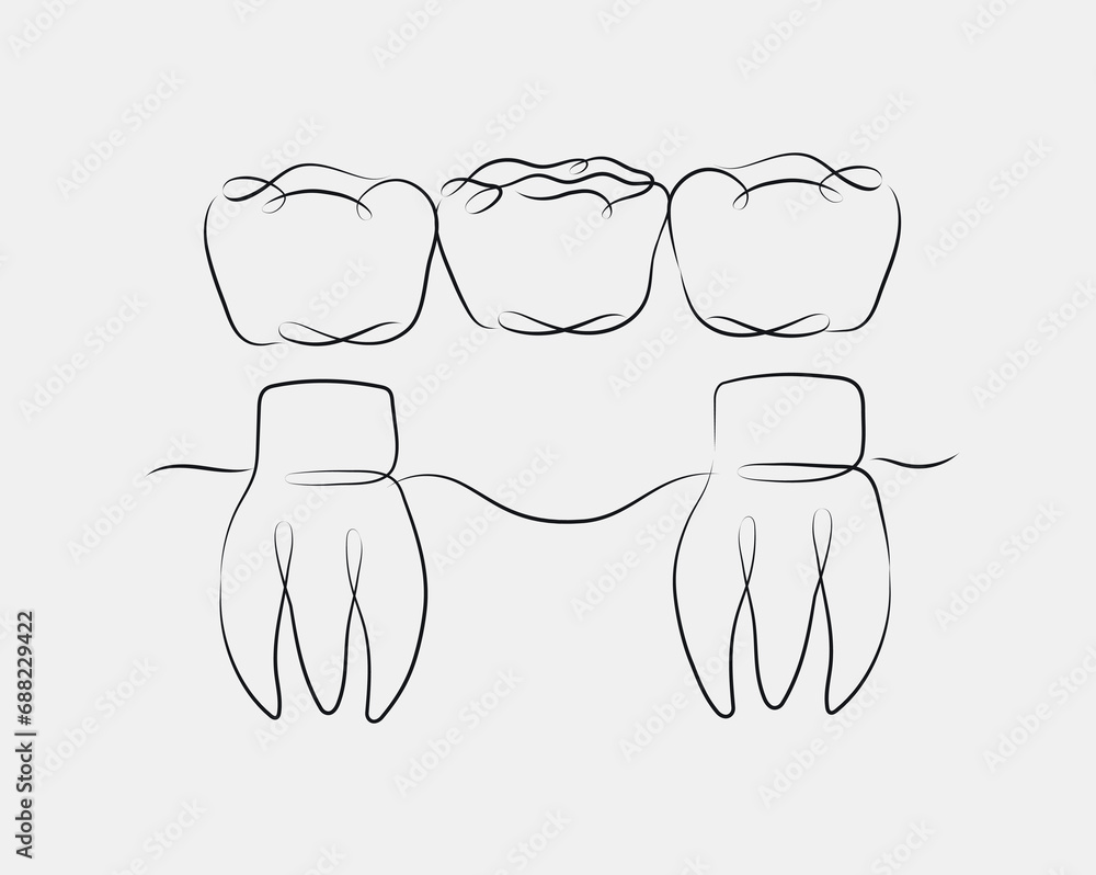 Teeth with crown bridge illustration drawing in linear style on white background