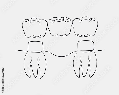 Obraz na płótnie Teeth with crown bridge illustration drawing in linear style on white background w salonie