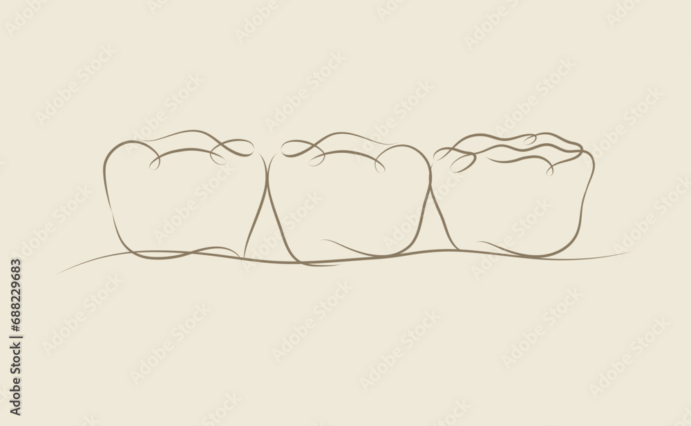 Implanted teeth with crown bridge illustration drawing in linear style on beige background