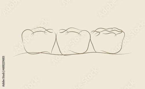 Obraz na płótnie Implanted teeth with crown bridge illustration drawing in linear style on beige background w salonie