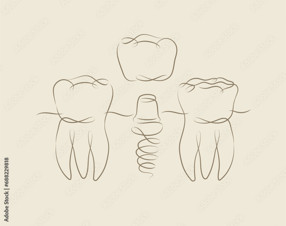 Teeth implant illustration drawing in linear style on beige background