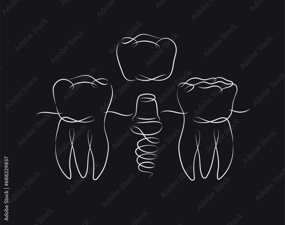 Teeth implant illustration drawing in linear style on black background
