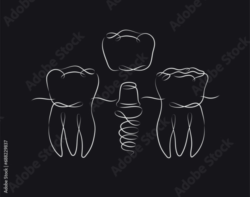 Obraz na płótnie Teeth implant illustration drawing in linear style on black background w salonie