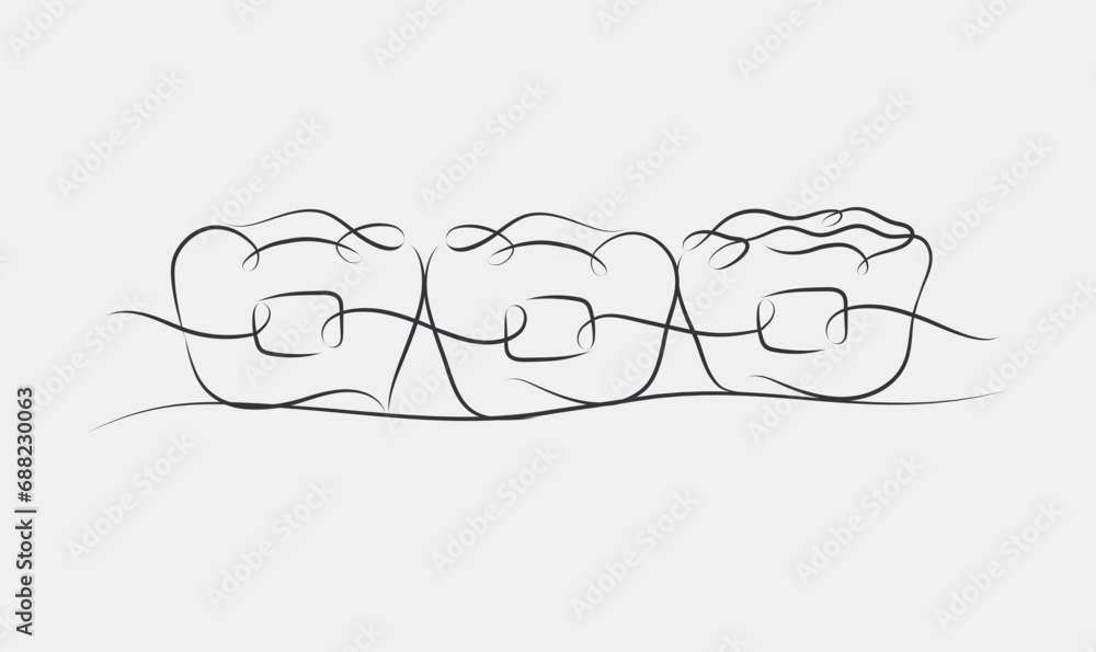 Teeth braces illustration drawing in linear style on white color background
