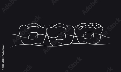 Obraz na płótnie Teeth braces illustration drawing in linear style on black color background w salonie