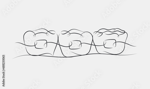 Teeth braces illustration drawing in linear style on white color background