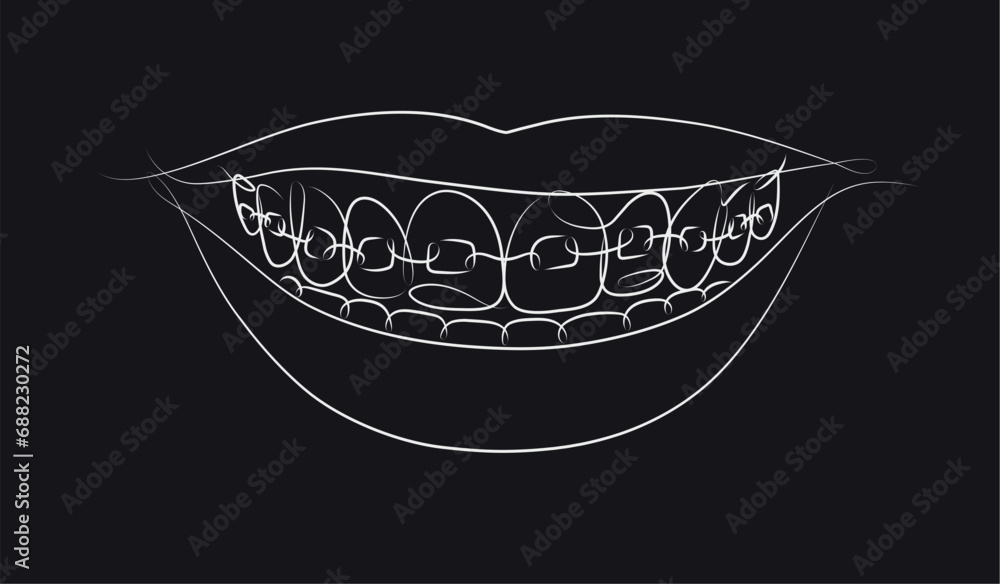 Smile with teeth braces in linear style drawing on black background