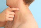 Young man pointing at moles on his neck against blue background, closeup