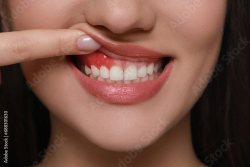 Φωτογραφία Woman showing inflamed gum, closeup. Oral cavity health