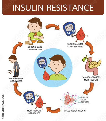 Insulin resistance syndrome, illustration cartoon on white background