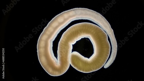 Nemertea worm Cephalothrix linearis under a microscope, class Palaeonemertea, order Archinemertea. The specimen was found in Barents Sea. photo