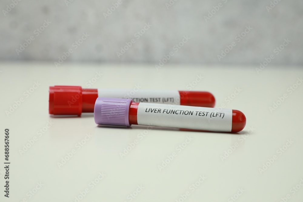 Liver Function Test. Tubes with blood samples on white table Liver Function Test. Tubes with blood samples on white table