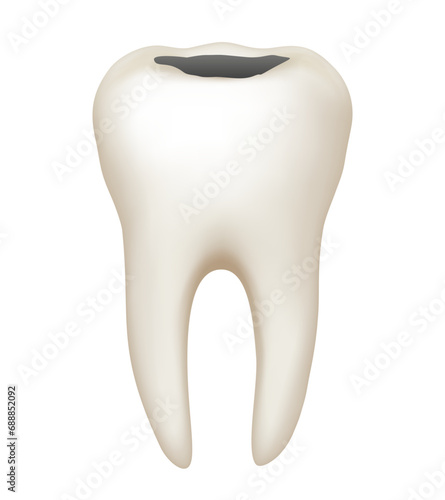 Tooth with caries. Vector clipart isolated on white background.