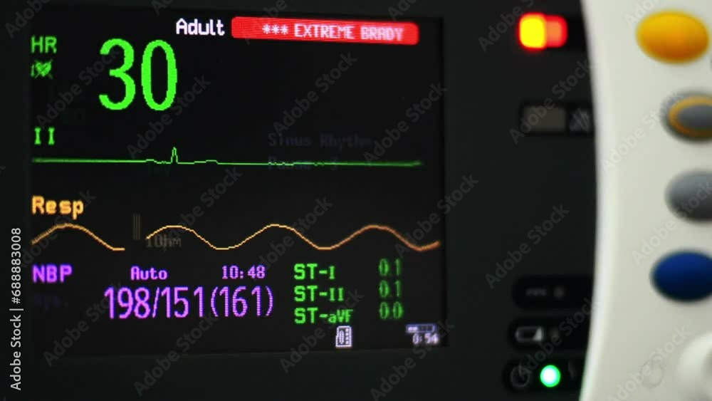 closeup ekg heart monitor flatline hospital machine ecg black and