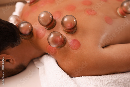 Cupping therapy. Closeup view of man with glass cups on his back indoors