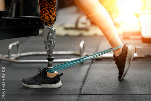 prosthetic, artificial leg. Woman with prosthetic leg using walking on treadmill while working out in gym. artificial leg. Woman wearing prosthetic equipment sit down after exercising in gym.
