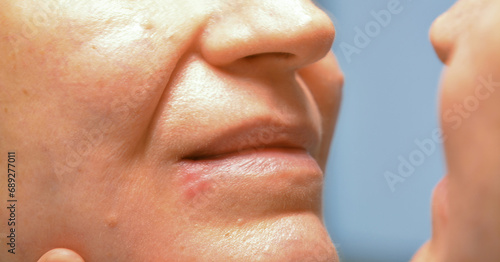 A close-up shot of the face of a 50+ woman looking at herpes on her lip and her facial skin in the mirror. photo