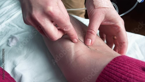 Nurse puts an IV on a man. POV of a man's arm with an IV needle in the median cubital vein (antecubital vein). A person is receiving intravenous fluid. Intravenous injections, medical care in a clinic photo