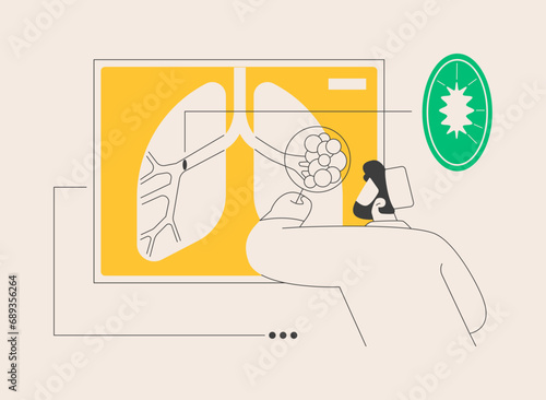 Chronic obstructive pulmonary disease abstract concept vector illustration.