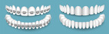 Teeth with or without braces orthodontic dentistry