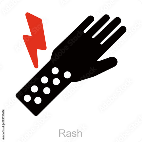 Rash