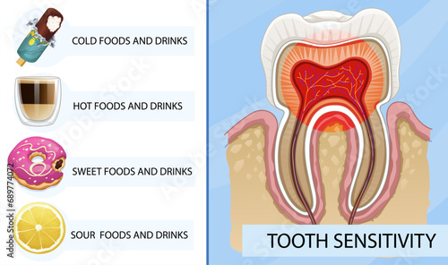 Unhealthy human tooth. Tooth sensitivity triggers. Sharp pain when eating some types of foods. Healthcare illustration, Vector illustration. 