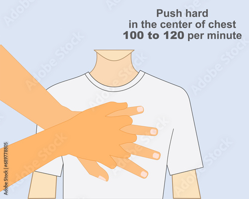 Correct hand technique for chest compression Emergency first aid CPR performance Health help emergency training vector illustration.