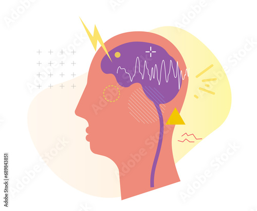 Epilepsy - A Neurological Condition - Stock Illustration