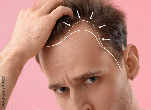 Upset young man with hair l...