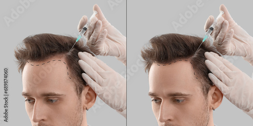 Young man before and after ...