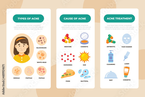 Acne Infographic, Causes of the disease, treatment. Types of acne. Skin Problems treatment. Vector Illustration.