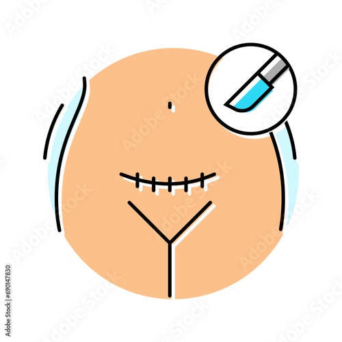 cesarean section gynecologist color icon vector. cesarean section gynecologist sign. isolated symbol illustration
