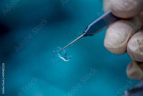 Foto Close-up of synthetic lens used during lens replacement cataract removal procedure